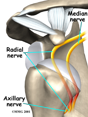 Any attempted shoulder movements cause extreme pain. Any attempted shoulder movements cause extreme pain.