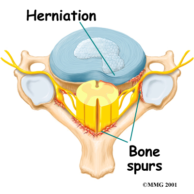 Radiologist detected a utton